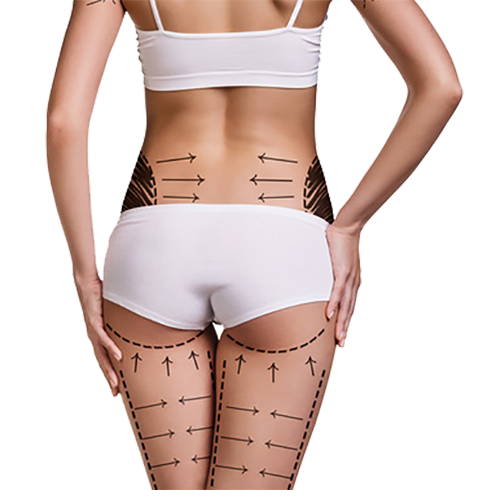 Body Contouring and Sculpting